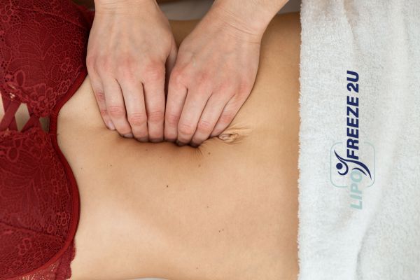 diastasis recti treatment Nottinghamshire