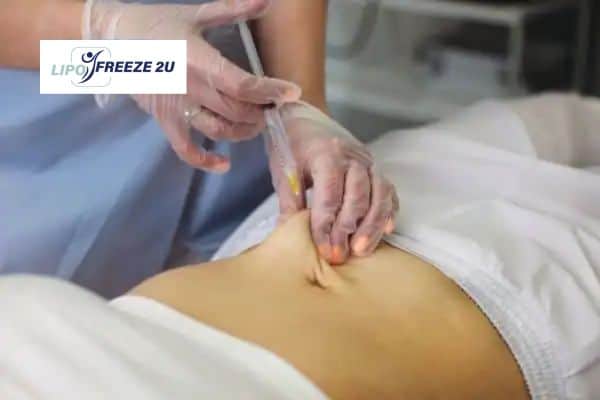 How Does Aqualyx Fat Dissolving Injection Work to Break Down Fat Nottinghamshire?
