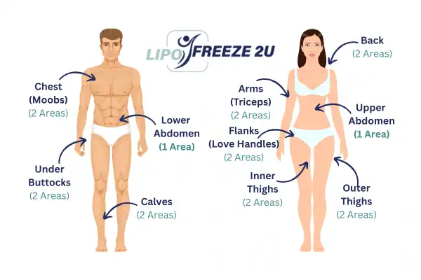 Areas you can have fat freezing treatment Nottinghamshire