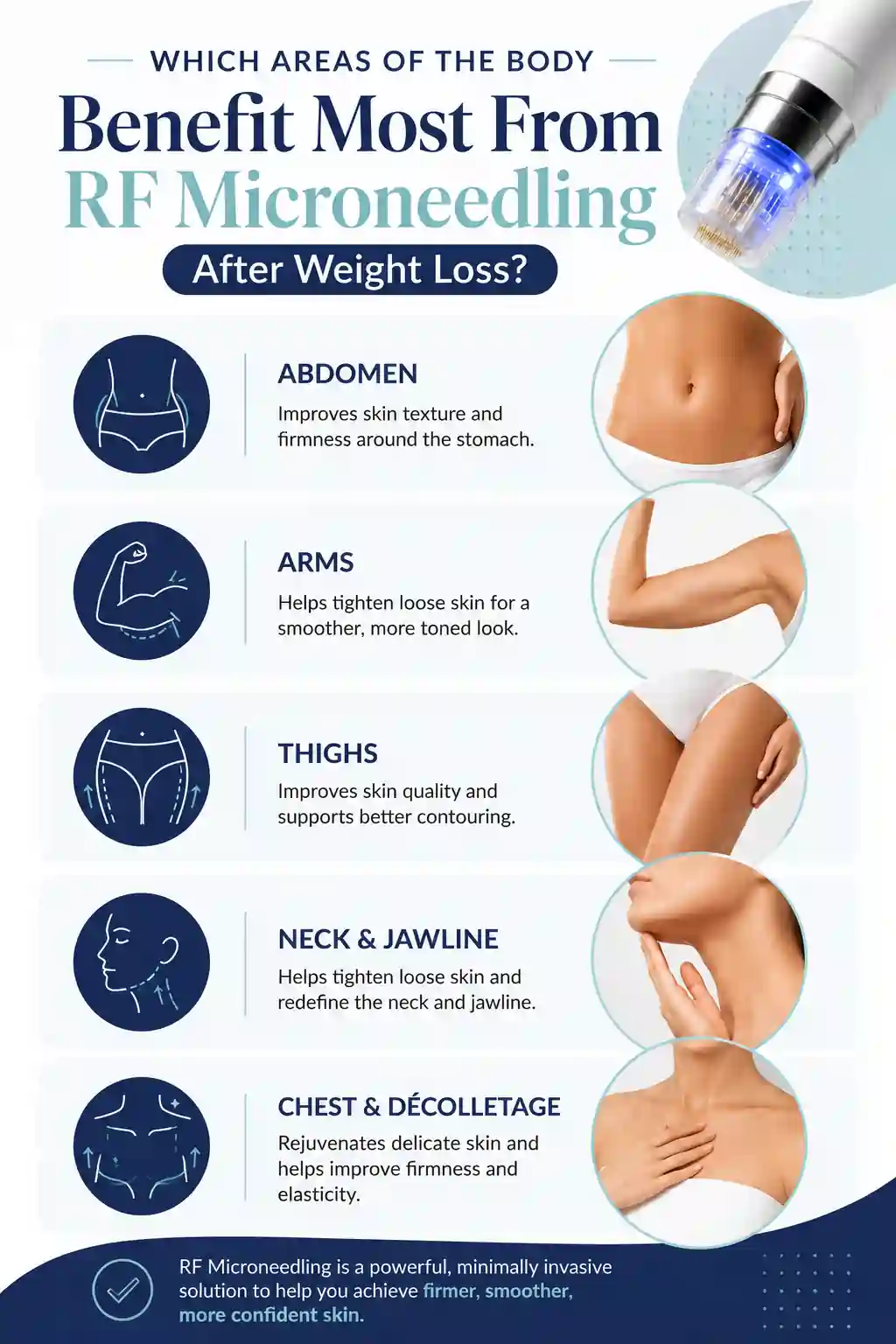 Which Areas of the Body Benefit Most From RF Microneedling After Weight Loss Nottinghamshire